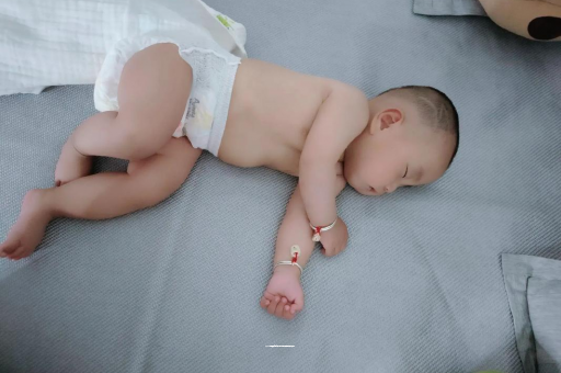 当阳六个月宝宝眼睛散光